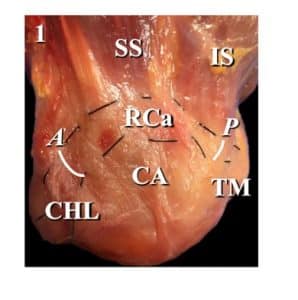 Rotator Cuff Repair Pittsburgh PA